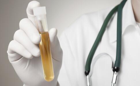 甲亢如何检查 甲亢有什么检查项目 甲亢怎么预防