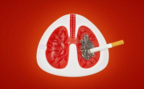 如何预防肺癌 导致肺癌的原因有哪些 怎么预防肺癌